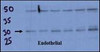 Endothelial cell lysate transferred to membrane was incubated with primary antibody at a 1:500 dilution in 2% BSA in TBST at 4deg C overnight. Data courtesy of Dr. Katherine Healey, NWCRF Institute, School of Biological Sciences, University of Wales Bangor.