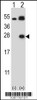 Western blot analysis of KLK6 using rabbit polyclonal KLK6 Antibody (L141) using 293 cell lysates (2 ug/lane) either nontransfected (Lane 1) or transiently transfected (Lane 2) with the KLK6 gene.