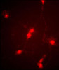Immunofluorescence image of cultured chick retinal amacrine (neuronal) cells labeled with CLC4 Antibody . Data courtesy of Emily McMains, Louisiana State University.