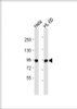 Western Blot at 1:1000 dilution Lane 1: Hela whole cell lysate Lane 2: HL-60 whole cell lysate Lysates/proteins at 20 ug per lane.