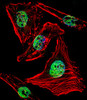 Fluorescent confocal image of Hela cell stained with ZBTB7B Antibody .Hela cells were fixed with 4% PFA (20 min) , permeabilized with Triton X-100 (0.1%, 10 min) , then incubated with ZBTB7B primary antibody (1:25) . For secondary antibody, Alexa Fluor 488 conjugated donkey anti-rabbit antibody (green) was used (1:400) .Cytoplasmic actin was counterstained with Alexa Fluor 555 (red) conjugated Phalloidin (7units/ml) . Nuclei were counterstained with DAPI (blue) (10 ug/ml, 10 min) . ZBTB7B immunoreactivity is localized to Nucleus significantly.