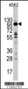 Western blot analysis of MYO1C Antibody in K562 cell line lysates (35ug/lane)