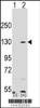 Western blot analysis of PARP1 using rabbit polyclonal PARP1 Antibody using 293 cell lysates (2 ug/lane) either nontransfected (Lane 1) or transiently transfected with the PARP1 gene (Lane 2) .