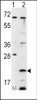 Western blot analysis of FXN using rabbit polyclonal FXN Antibody using 293 cell lysates (2 ug/lane) either nontransfected (Lane 1) or transiently transfected with the FXN gene (Lane 2) .