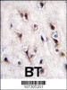 Formalin-fixed and paraffin-embedded human brain tissue reacted with NURR1 (NR4A2) antibody (N-term) , which was peroxidase-conjugated to the secondary antibody, followed by DAB staining.