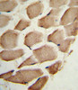 Formalin-fixed and paraffin-embedded human skeletal muscle reacted with ARPC1A Antibody, which was peroxidase-conjugated to the secondary antibody, followed by DAB staining.