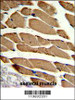 Formalin-fixed and paraffin-embedded human skeletal muscle reacted with ACTR2 Antibody, which was peroxidase-conjugated to the secondary antibody, followed by DAB staining.