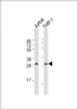 Western Blot at 1:1000 dilution Lane 1: Jurkat whole cell lysate Lane 2: THP-1 whole cell lysate Lysates/proteins at 20 ug per lane.