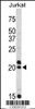 Western blot analysis of VIP antibody in Jurkat cell line lysates (35ug/lane)