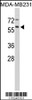 Western blot analysis of in MDA-MB231 cell line lysates (35ug/lane)