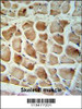 Calponin-3 Antibody IHC analysis in formalin fixed and paraffin embedded human skeletal muscle tissue followed by peroxidase conjugation of the secondary antibody and DAB staining.