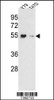 Western blot analysis of EEF1A1/ EEF1A2 Antibody in Y79, T47D cell line lysates (35ug/lane) .