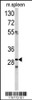 Western blot analysis of CDCA3 antibody in mouse spleen tissue lysates (35ug/lane)