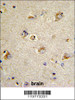 Formalin-fixed and paraffin-embedded human brain tissue reacted with CDCA3 Antibody (N-term) , which was peroxidase-conjugated to the secondary antibody, followed by DAB staining.