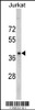 Western blot analysis of RRM2 antibody in Jurkat cell line lysates (35ug/lane)