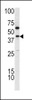 Western blot analysis of TDG antibody in K562 cell line lysates (35ug/lane)