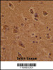 Formalin-fixed and paraffin-embedded human brain tissue with CTDP1 Antibody (N-term) , which was peroxidase-conjugated to the secondary antibody, followed by DAB staining.