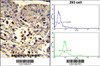 (LEFT) Formalin-fixed and paraffin-embedded human hepatocarcinoma reacted with ETHE1 Antibody, which was peroxidase-conjugated to the secondary antibody, followed by DAB staining. (RIGHT) Flow cytometric analysis of 293 cells using ETHE1 Antibody (bottom histogram) compared to a negative control cell (top histogram) . FITC-conjugated goat-anti-rabbit secondary antibodies were used for the analysis.
