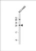 Western Blot at 1:2000 dilution + NCI-H460 whole cell lysate Lysates/proteins at 20 ug per lane.