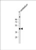 Western Blot at 1:1000 dilution + human cerebellum lysate Lysates/proteins at 20 ug per lane.