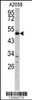 Western blot analysis of GAS7 antibody in A2058 cell line lysates (35ug/lane)