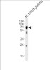 Western blot analysis of lysate from human blood plasma tissue lysate, using HPX Antibody at 1:1000 at each lane.