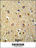 Formalin-fixed and paraffin-embedded human brain reacted with NKRF Antibody, which was peroxidase-conjugated to the secondary antibody, followed by DAB staining.