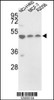 Western blot analysis of in NCI-H460, MCF-7, A2058 cell line lysates (35ug/lane)