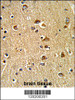 Formalin-fixed and paraffin-embedded human brain tissue reacted with, which was peroxidase-conjugated to the secondary antibody, followed by DAB staining.