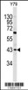 Western blot analysis of PRELP antibody in Y79 cell line lysates (35ug/lane)