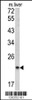 Western blot analysis of SPCS3 antibody in mouse liver tissue lysates (35ug/lane)