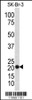 Western blot analysis of TAGLN antibody in SK-Br-3 cell line lysates (35ug/lane)