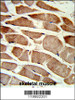 Formalin-fixed and paraffin-embedded human skeletal muscle reacted with TAGLN Antibody, which was peroxidase-conjugated to the secondary antibody, followed by DAB staining.