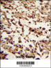 Formalin-fixed and paraffin-embedded human testis tissue reacted with TBP Antibody, which was peroxidase-conjugated to the secondary antibody, followed by DAB staining.