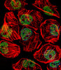Fluorescent confocal image of U251 cell stained with TBP Antibody.U251 cells were fixed with 4% PFA (20 min) , permeabilized with Triton X-100 (0.1%, 10 min) , then incubated with TBP primary antibody (1:25) . For secondary antibody, Alexa Fluor 488 conjugated donkey anti-rabbit antibody (green) was used (1:400) .Cytoplasmic actin was counterstained with Alexa Fluor 555 (red) conjugated Phalloidin (7units/ml) . Nuclei were counterstained with DAPI (blue) (10 ug/ml, 10 min) .TBP immunoreactivity is localized to Nucleus significantly.