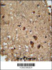 RAN antibody immunohistochemistry analysis in formalin fixed and paraffin embedded human brain tissue followed by peroxidase conjugation of the secondary antibody and DAB staining.