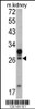 Western blot analysis of in mouse kidney tissue lysates (35ug/lane)