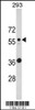 Western blot analysis of KRT10 Antibody in 293 cell line lysates (35ug/lane)