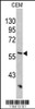 Western blot analysis of KRT10 antibody in CEM cell line lysates (35ug/lane)