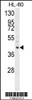 Western blot analysis of LRG1 Antibody in HL-60 cell line lysates (35ug/lane)