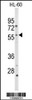 Western blot analysis of CYP2C19 Antibody in HL-60 cell line lysates (35ug/lane)