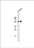 Western Blot at 1:2000 dilution + human liver lysate Lysates/proteins at 20 ug per lane.