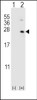 Western blot analysis of HPRT1 using rabbit polyclonal HPRT1 Antibody using 293 cell lysates (2 ug/lane) either nontransfected (Lane 1) or transiently transfected (Lane 2) with the HPRT1 gene.