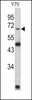 Western blot analysis of Lamin B2 Antibody in Y79 cell line lysates (35ug/lane)