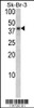 Western blot analysis of BGN Antibody in Sk-Br-3 cell line lysates (35ug/lane)