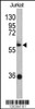 Western blot analysis of ZBTB2 antibody in Jurkat cell line lysates (35ug/lane)