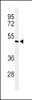 Western blot analysis of Smad7 Antibody in ZR-75-1 cell line lysates (35ug/lane)