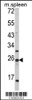 Western blot analysis of FKBP11 Antibody in mouse spleen tissue lysates (35ug/lane)