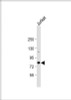 Western Blot at 1:1000 dilution + Jurkat whole cell lysate Lysates/proteins at 20 ug per lane.