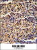 Formalin-fixed and paraffin-embedded human spleen reacted with ALKBH8 Antibody, which was peroxidase-conjugated to the secondary antibody, followed by DAB staining.